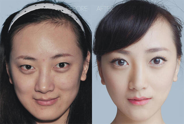 plastic-surgery-ba8.jpg