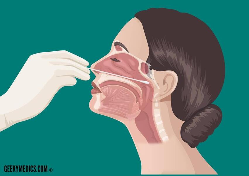 19-36-25-Nasopharyngeal-Swab-1.jpg